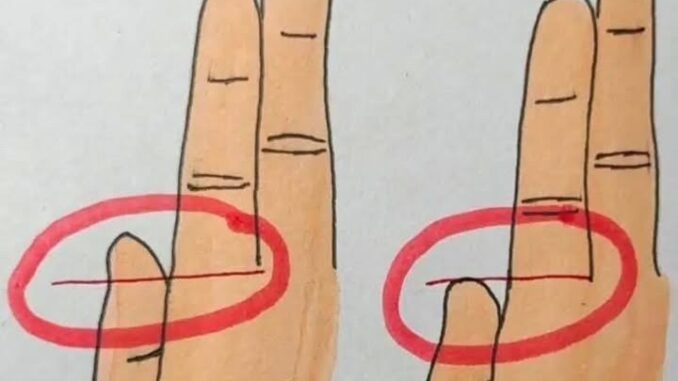 119