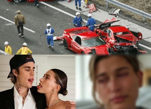 183